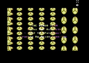 2112 The Battle for Planet Earth (1992)(Binary Zone)(PD)[h TBT] Profile Picture